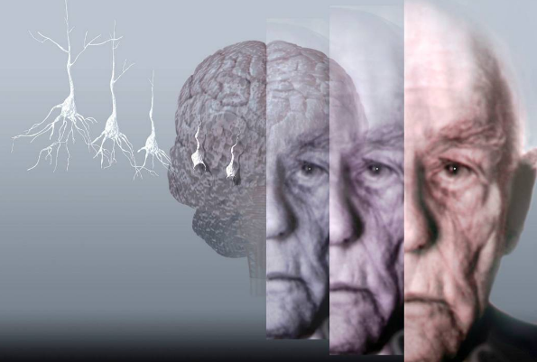 中国药科大学一项研究表明：大麻二酚CBD有助于预防和减轻阿尔茨海默病