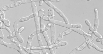 新突破！中国以色列联合研究利用酵母生物合成大麻素
