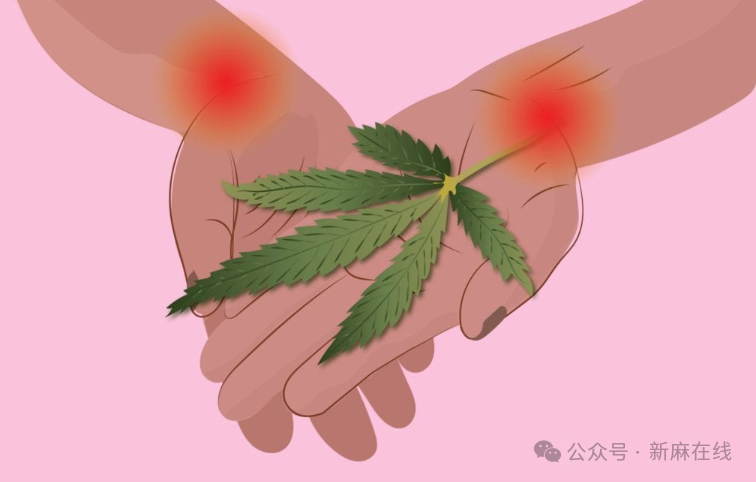 《临床风湿病学》杂志：医用大麻有助于治疗纤维肌痛