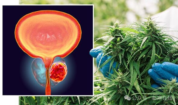 《医用大麻与大麻素》杂志：大麻可能是一种治疗前列腺癌的有效方法