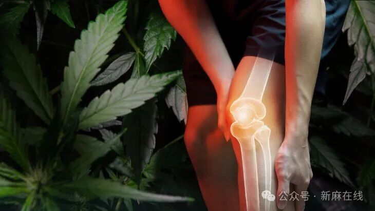 以色列最新研究称，CBG 有望用于治疗类风湿性关节炎